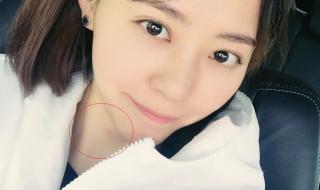 为什么有些人头发易惹蚊子 蚊子居然还有头发